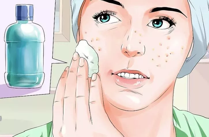 Rubbing Mouthwash On Your Face?! After Reading This You’ll Definitely Try It!