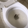 Man Finds “Snake” In His Toilet – When Expert Sees It, He Whispers: “That’s Not A Snake…”