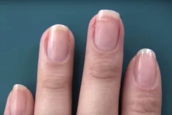 Ouch, A Torn Nail! With This Weird Trick You Could Repair It In No Time