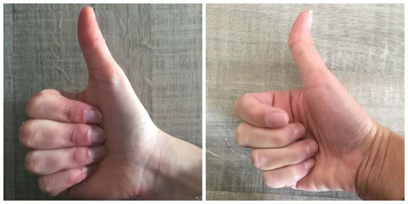 Is Your Thumb Straight Or Crooked? This Is What It Can Tell You About Your Personality!