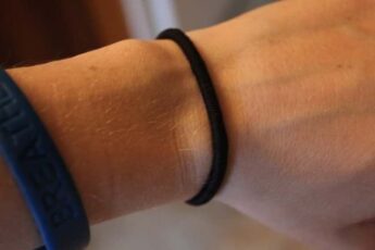 WARNING: Do You Wear Hair Ties Around Your Wrist? You’d Better Stop! It’s Really Dangerous!