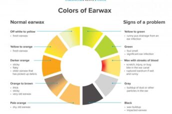 Ear Wax Color Chart: What Can Ear Wax Reveal About Your Health?