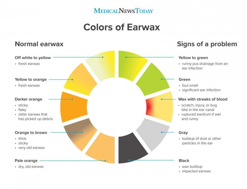 Ear Wax Color Chart: What Can Ear Wax Reveal About Your Health?