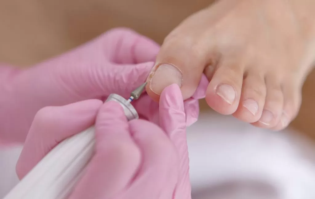 Ingrown Toenail: Causes And Treatment